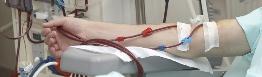 Dialysis (24*7)